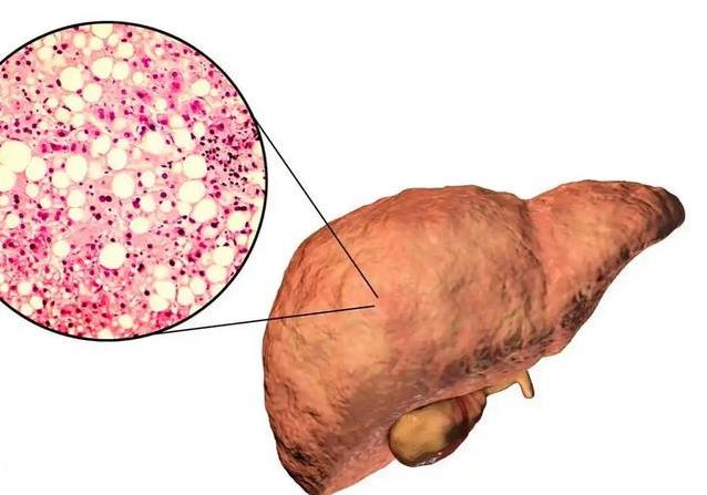 msn, 血管就不容, 结实 msn, 血管就不容, 结实